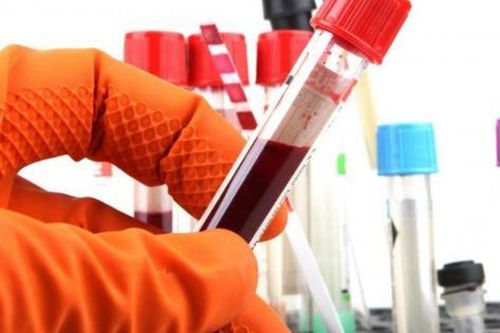 WHO hướng dẫn về xét nghiệm và chẩn đoán STI trong đó có HIV