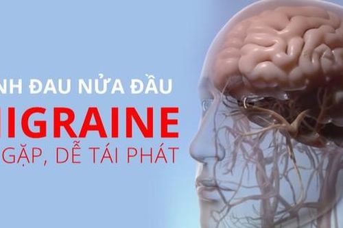 Bệnh đau nửa đầu điều trị như thế nào?