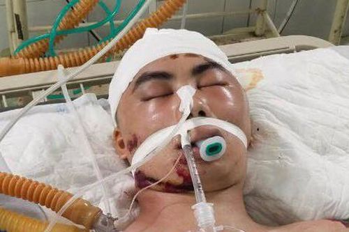 MS 882: Xót xa gia cảnh nam thanh niên dân tộc Tày hôn mê sâu vì tai nạn