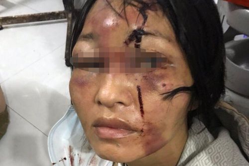 Gã 'chồng hờ' đánh đập vợ con tàn bạo