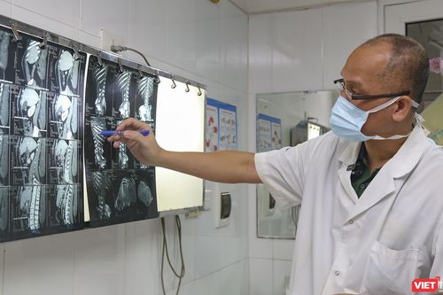 Phẫu thuật cắt bỏ thành công khối u khổng lồ to hơn cả người bệnh