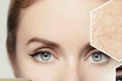 Da mặt bong tróc, ngứa rát sau khi sử dụng hoạt chất 'đảo ngược lão hóa'