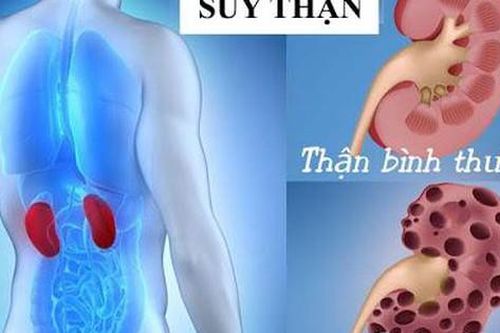 Suy thận do uống cỏ mực, dấu hiệu cảnh báo căn bệnh này