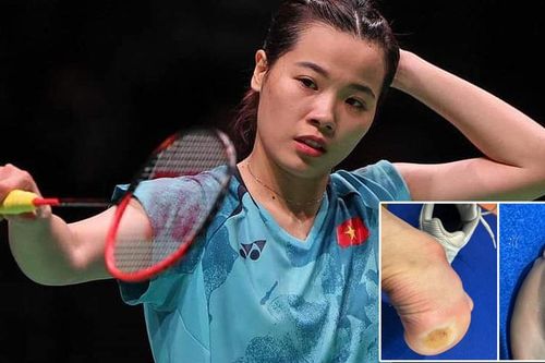 Cận cảnh gót chân Thùy Linh bị trầy xước sau trận thua ở giải Đan Mạch mở rộng