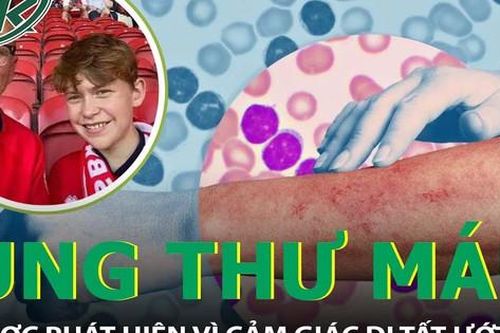 Cảm giác như đi tất ướt khiến người đàn ông phát hiện mắc ung thư khó chữa