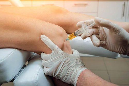Đau khớp lúc giao mùa dùng thuốc gì?