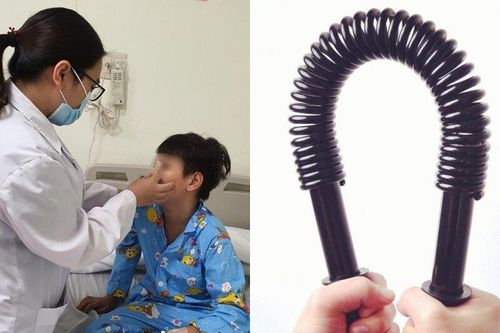 Xem bạn bẻ 'đồ long đao', bé trai bị đập gãy xương mũi