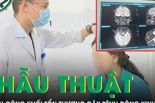 Phẫu thuật cắt bỏ thành công khối tổn thương gây bệnh động kinh hiếm gặp