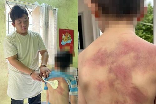 Cha bạo hành con ruột ở Đồng Nai: Dùng dây sạc, xẻng nấu ăn đánh con