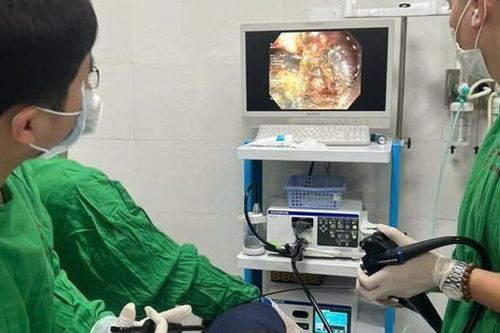 2 biểu hiện sớm của ung thư dạ dày, khi nào nên khám tầm soát?