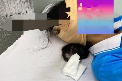 Đang uống nước trong sân trường nữ sinh bị lưỡi dao găm trúng đầu