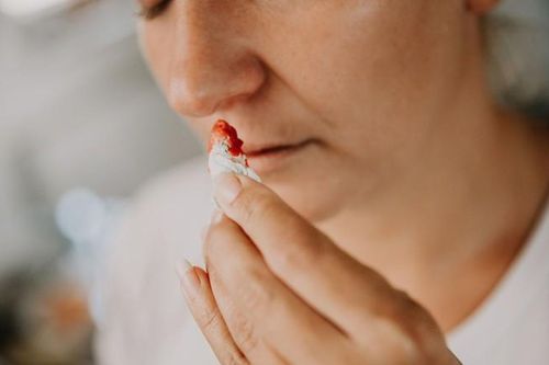 Vừa đau đầu vừa chảy máu cam là do đâu? Khi nào cần thăm khám bác sĩ?
