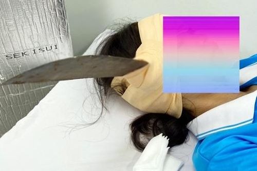 Nữ sinh đang ngồi uống nước, bất ngờ lưỡi dao găm vào đầu