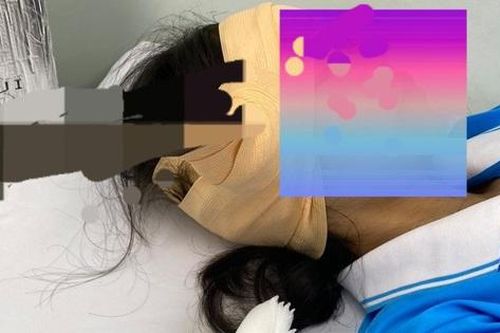 Nữ sinh bị lưỡi dao găm trúng đầu giữa sân trường