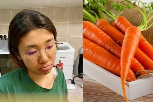 Ăn quá nhiều cà rốt, người phụ nữ 'biến hình' kinh dị