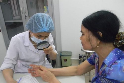 Điều trị bệnh vảy nến thế nào để tránh tái phát?