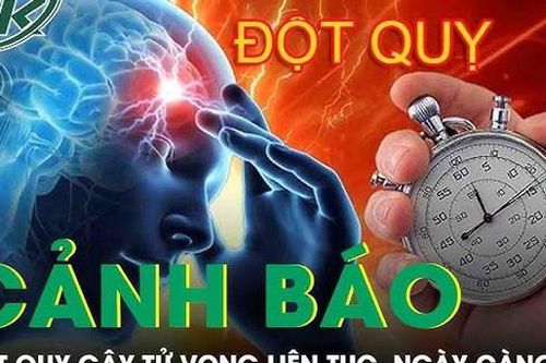 Các thói quen cần bỏ ngay để tránh tử vong vì đột quỵ