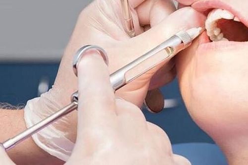 Đi chữa răng, người đàn ông bị ngộ độc thuốc tê toàn thân