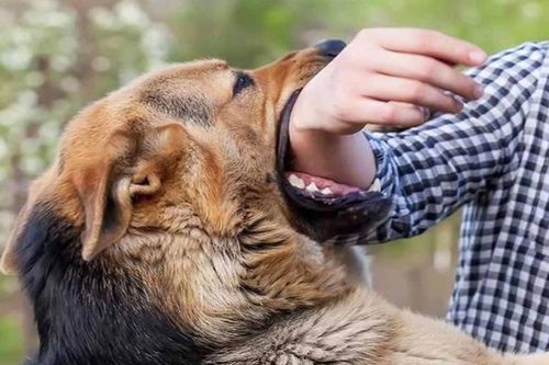 Bé gái 3 tuổi khâu 16 mũi vì chó cắn: Giây phút mẹ cứu con