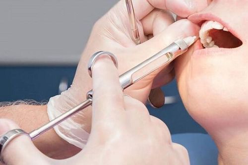 'Suýt chết' sau khi tiêm thuốc tê làm răng