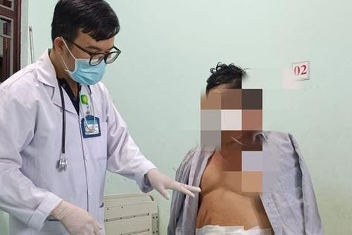 Người đàn ông vỡ ruột thừa sau một thời gian đau bụng và tự điều trị