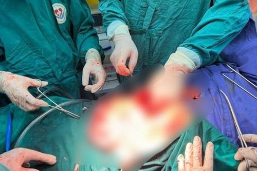 Cứu bệnh nhân đa chấn thương, nguy cơ tử vong ngay lập tức