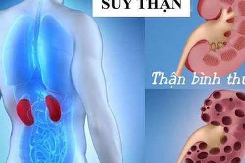 5 món cháo thuốc tốt cho người suy thận mạn tính