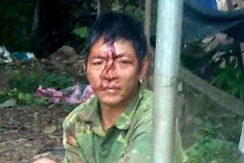 Chồng dùng điếu cày đánh vợ tử vong vì không cho dùng điện thoại