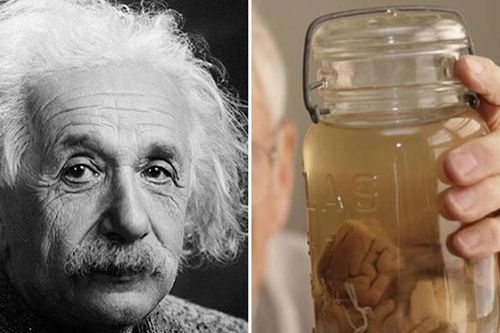 Bác sĩ 'điên rồ' nào cả gan đánh cắp bộ não của thiên tài Einstein?