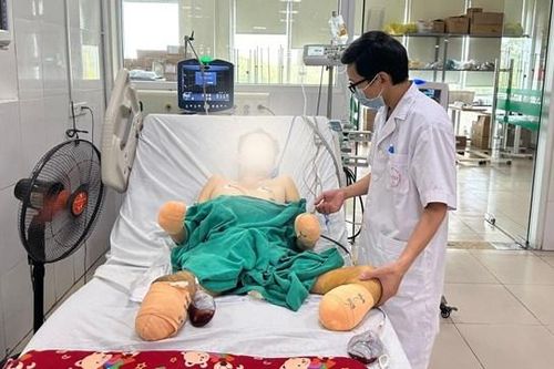 Nhiễm khuẩn liên cầu lợn, bệnh nhân phải tháo khớp tay chân
