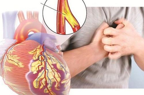 Người suy tim có dấu hiệu như nào?