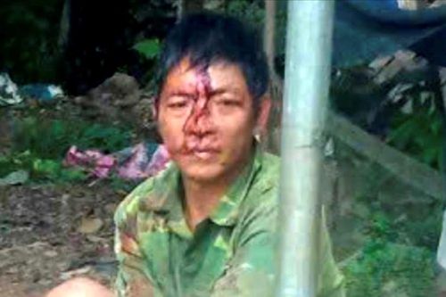 Đánh vợ bằng điếu cày dẫn đến tử vong vì không cho dùng điện thoại