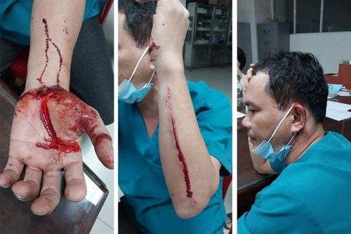 Điều tra vụ cán bộ điều dưỡng Bệnh viện Đa khoa Bình Phước bị hành hung