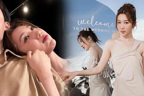 Thúy Ngân dính nghi vấn 'trùng tu' nhan sắc với chiếc cằm khác lạ