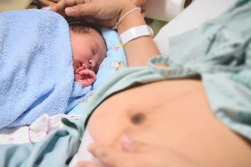 4 nguyên nhân khiến các mẹ đẻ mổ lần 2 có cảm giác đau đớn hơn lần đầu
