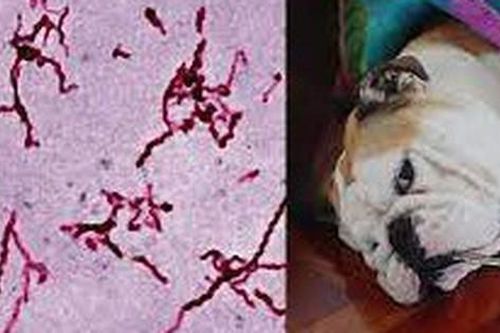 Nhiễm trùng huyết do xoắn khuẩn Leptospira, ai cần cảnh giác?