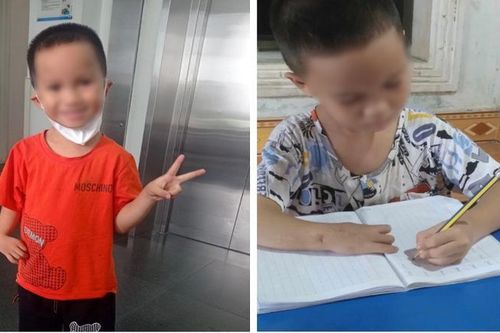 'Phép màu' đến với những bệnh nhi có đôi tay bị di tật