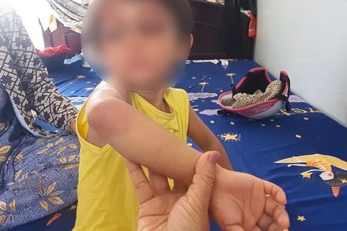 Bé gái 4 tuổi bị cha nuôi bạo hành được 'Bảo vệ khẩn cấp'