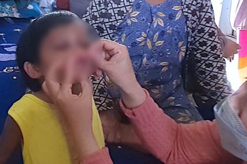 Cà Mau: Bảo vệ khẩn cấp cháu bé bị cha nuôi bạo hành