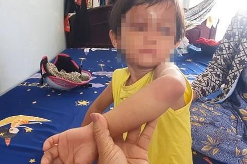 Bé gái bị cha nuôi đánh ở Cà Mau được đưa vào trung tâm bảo trợ diện 'bảo vệ khẩn cấp'