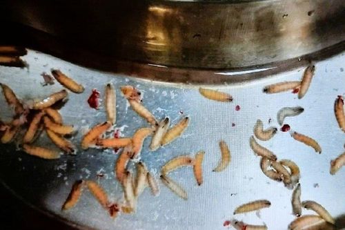 Thấy mũi có mùi hôi, đi khám người đàn ông tá hỏa phát hiện hàng chục 'vật lạ' trong mũi