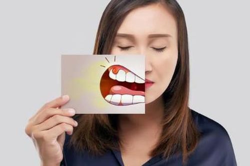 9 bài thuốc trị chứng hôi miệng do nóng trong