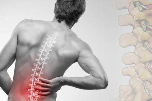 Đau thần kinh tọa ở người trẻ do đâu và cách khắc phục