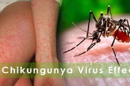 Mỹ phê duyệt vaccine ngừa virus chikungunya đầu tiên trên thế giới