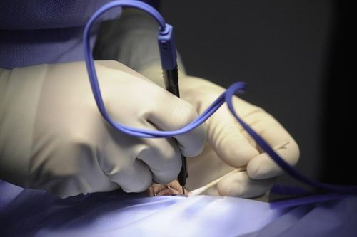Sau mổ mắt cận thị, bệnh nhân 18 tuổi 'kêu cứu' vì thị lực còn 2/10