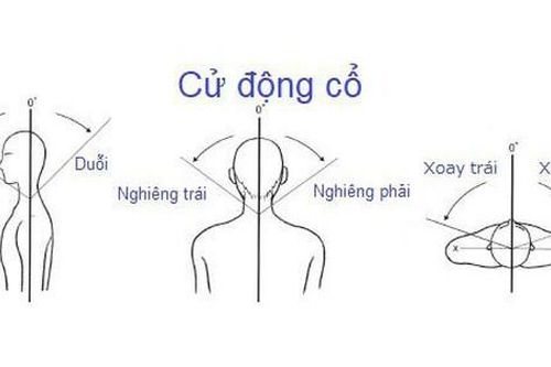 Biện pháp giảm đau cột sống cổ