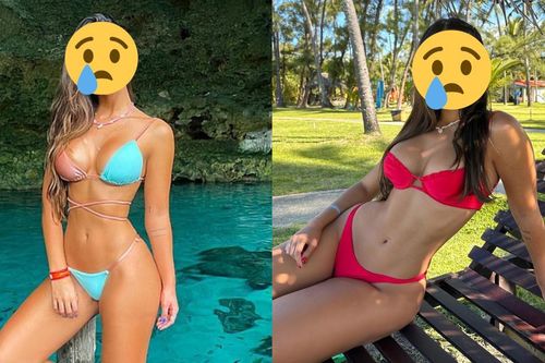 Nữ KOL nóng bỏng qua đời vì hút mỡ, nhìn thân hình mới thấy tiếc nuối