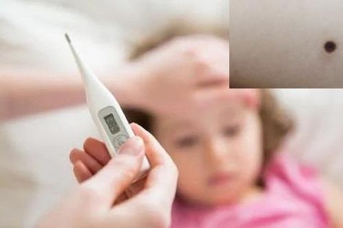 Phát hiện ca bệnh nhi bị sốt mò đầu tiên tại miền Nam