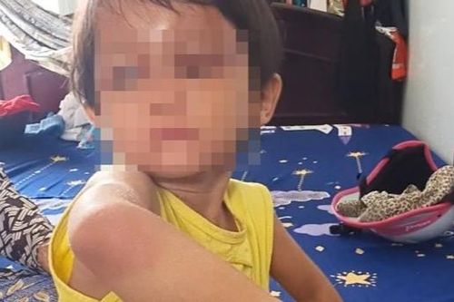 Thông tin mới nhất về vụ bé gái bị cha nuôi bạo hành