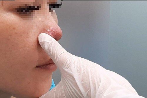 Tin tức Đời sống 14/11: Hệ lụy từ làm đẹp 'cấp tốc'